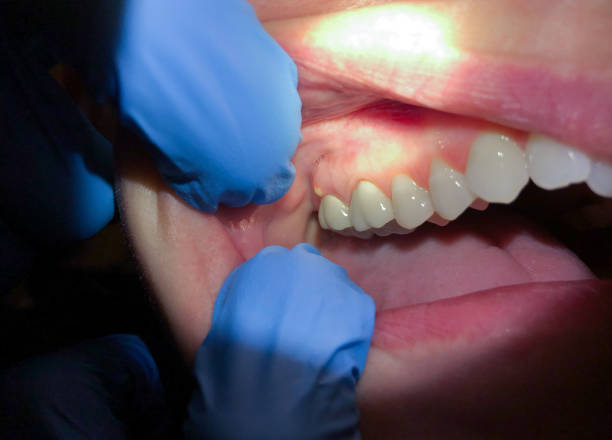 Best Walk-In Emergency Dental Services in Genesee, ID
