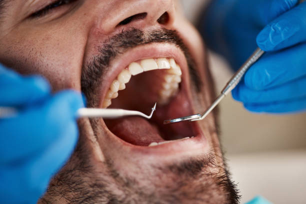 Best Emergency Denture Repair in Genesee, ID